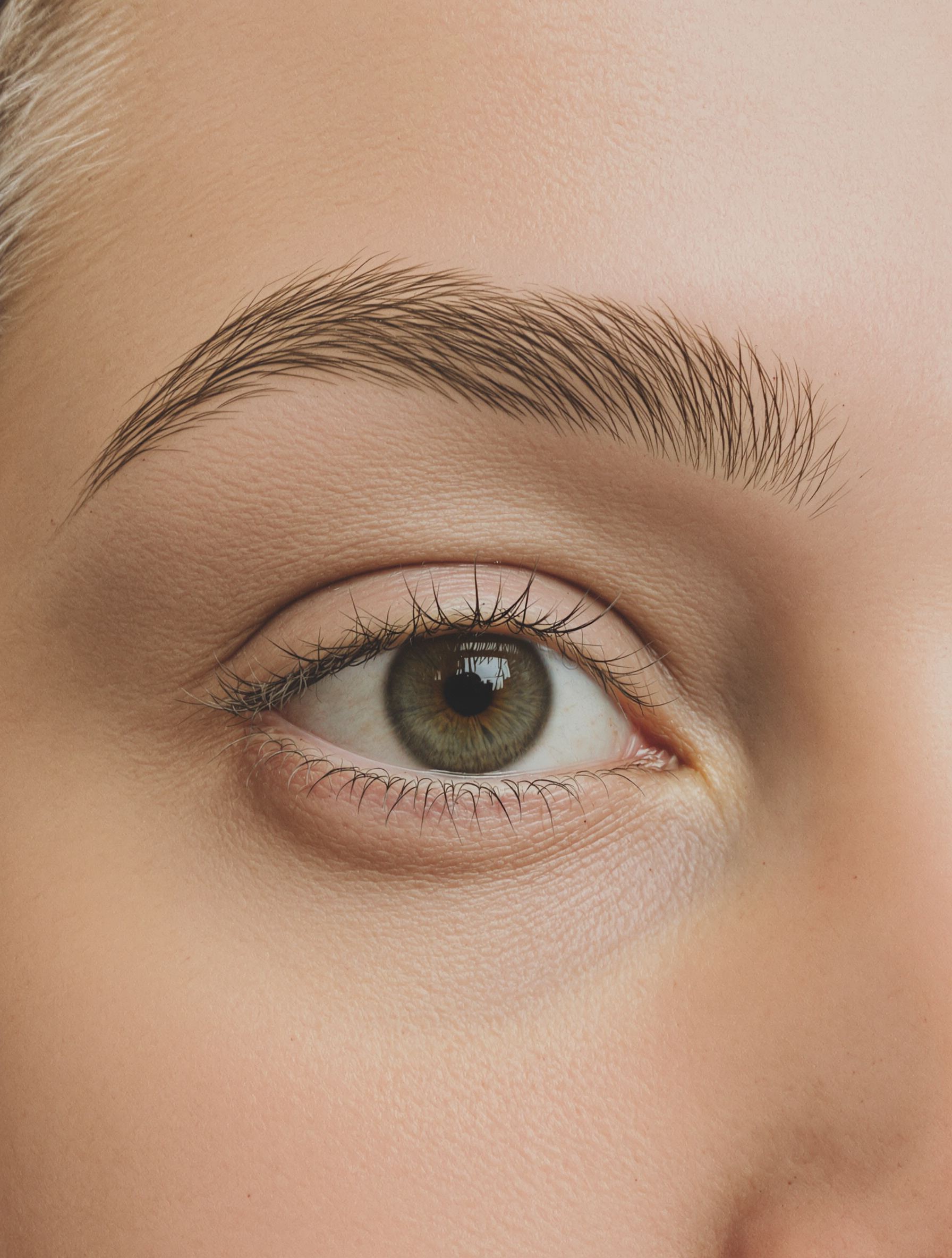 Anti-wrinkle injections: Brow Lift