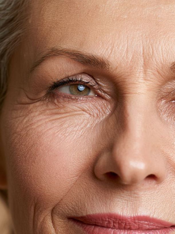 Aged Skin