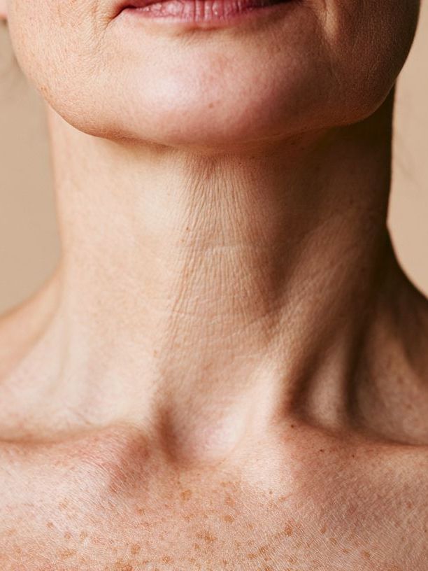 Aging Décolletage