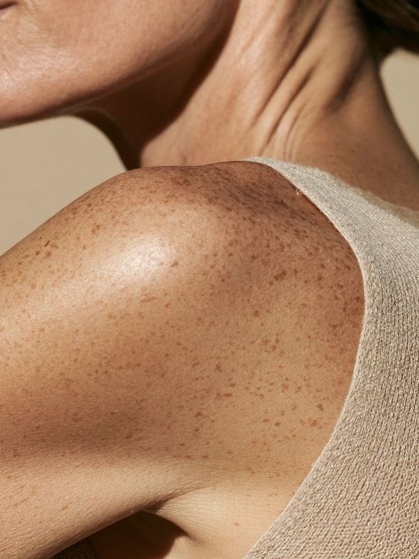 Brown Spots