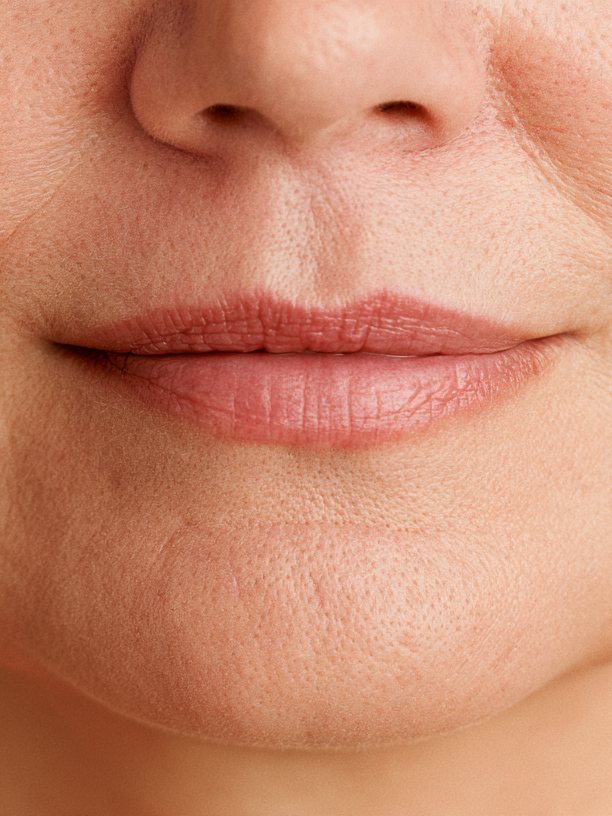 Cobblestone Chin