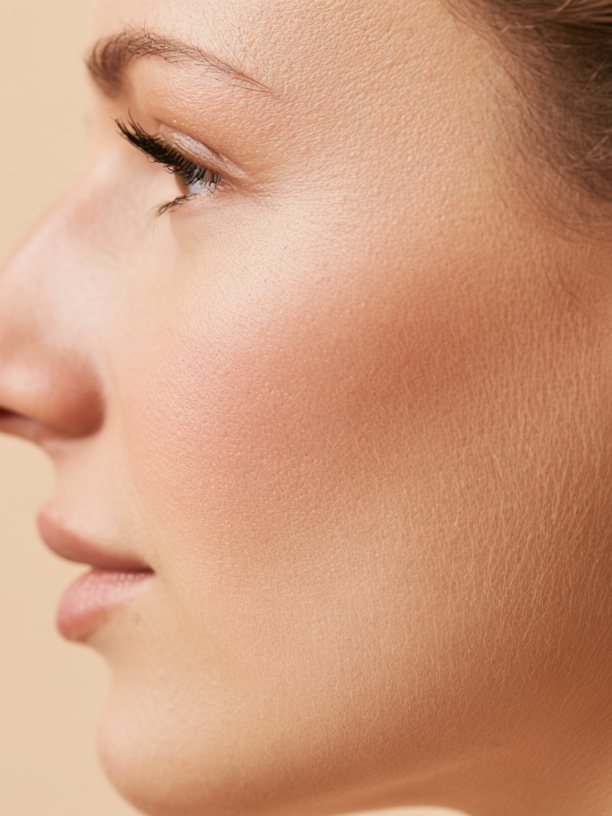 Misshapen Nose