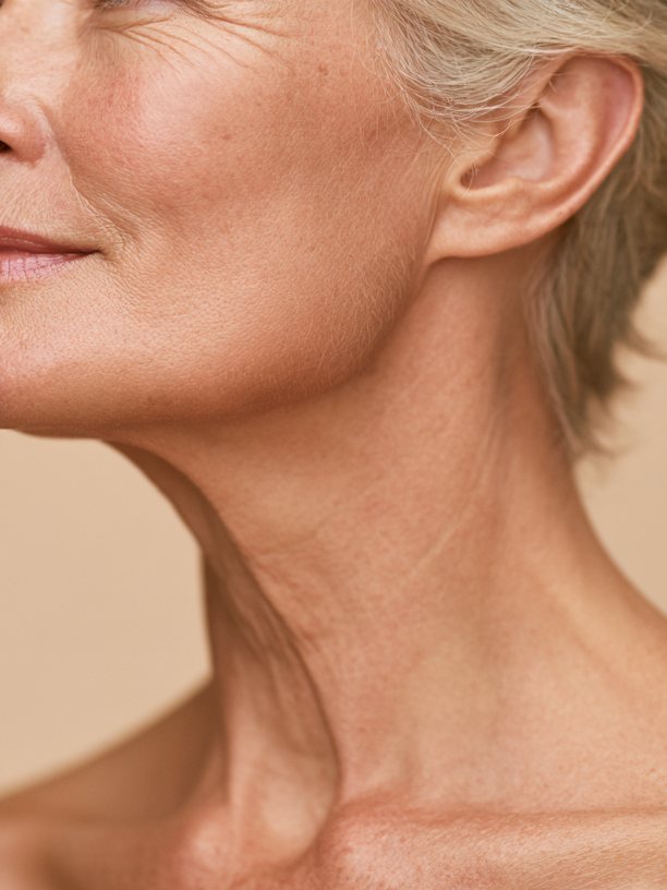 Sagging Neck