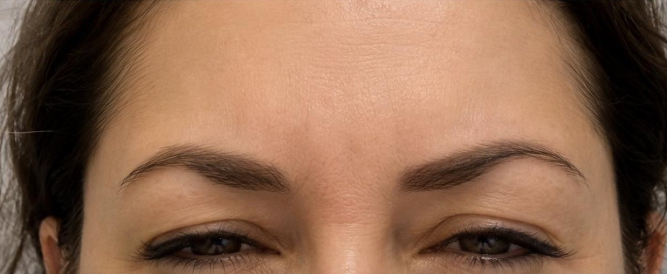 Patient photo after treatment