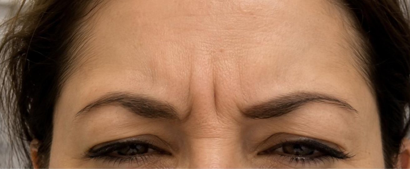 Patient photo before treatment