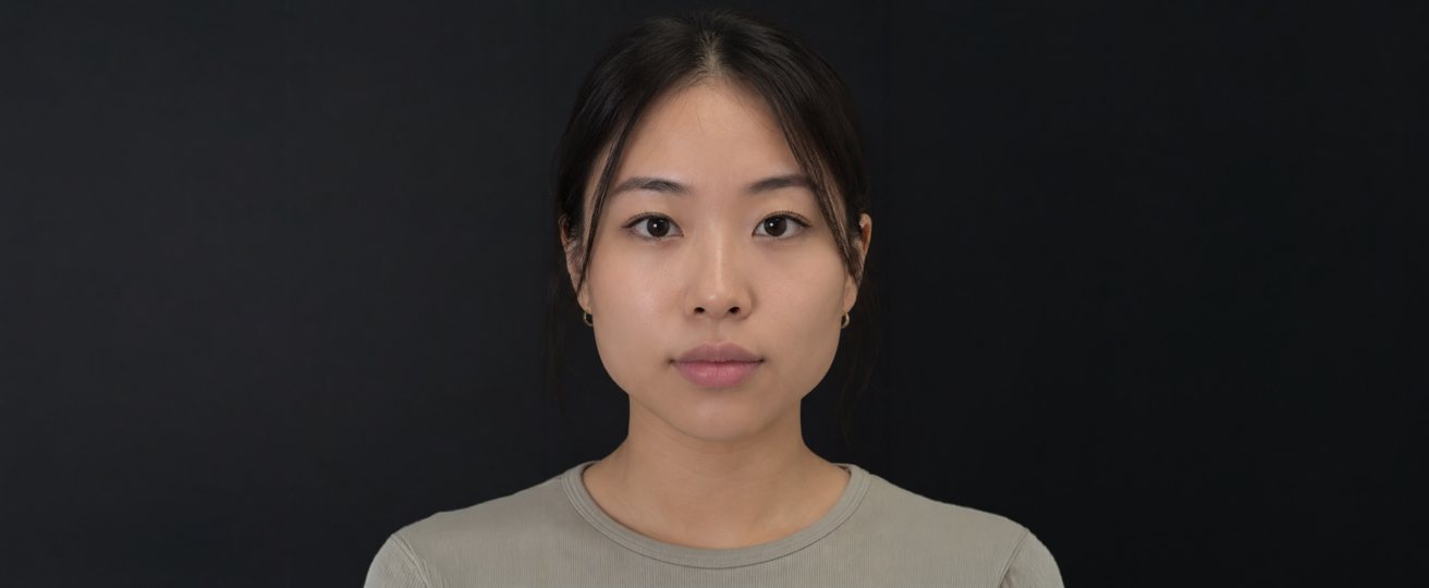 Patient photo before treatment