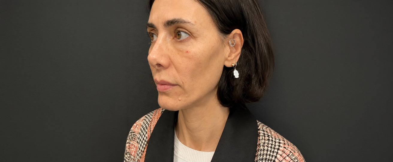 Patient photo before treatment