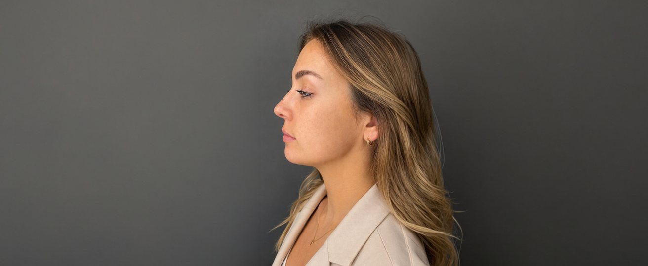 Patient photo before treatment