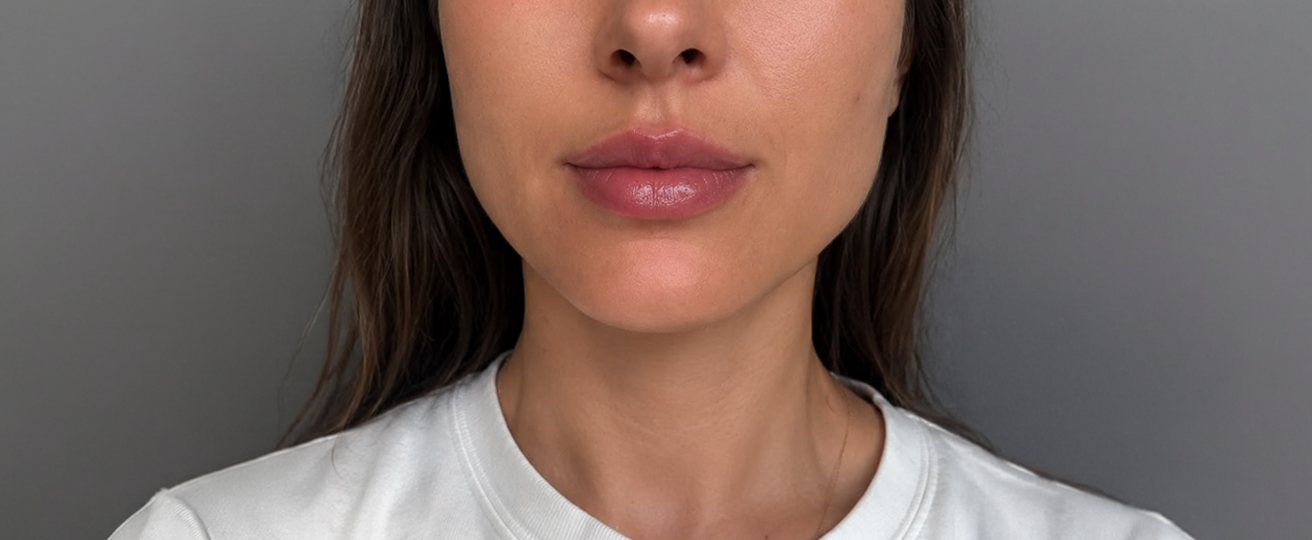 Patient photo after treatment