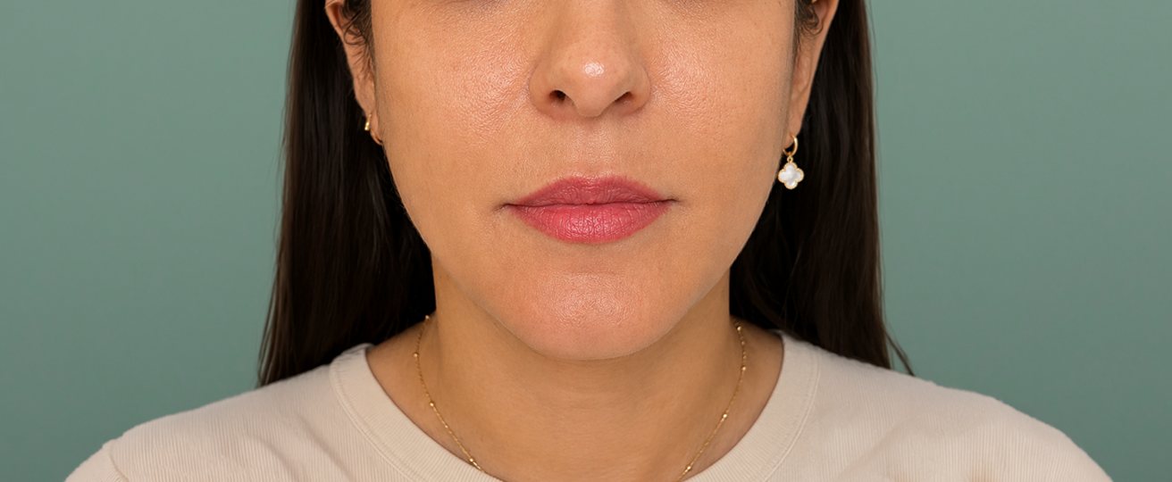 Patient photo after treatment