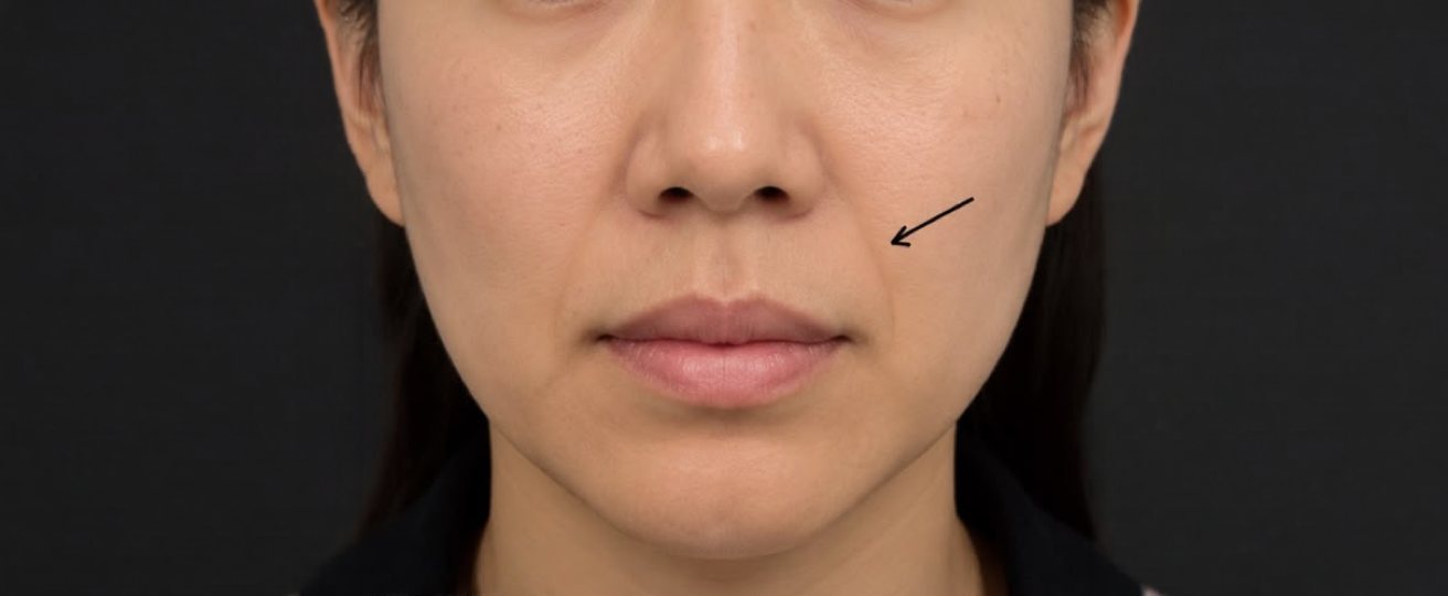 Patient photo before treatment