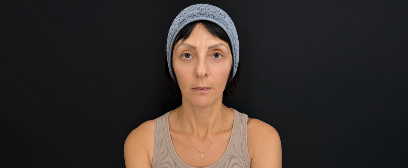 Patient photo after treatment