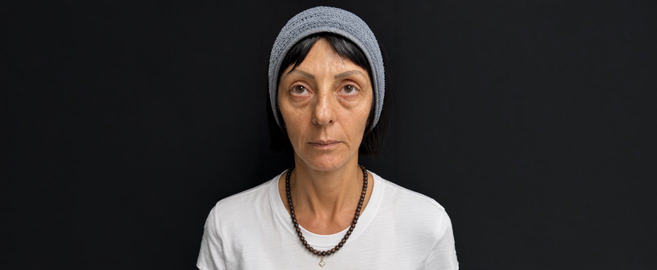 Patient photo before treatment