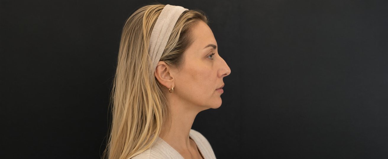 Patient photo before treatment
