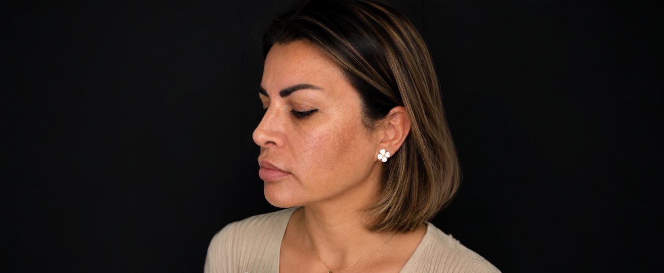 Patient photo before treatment