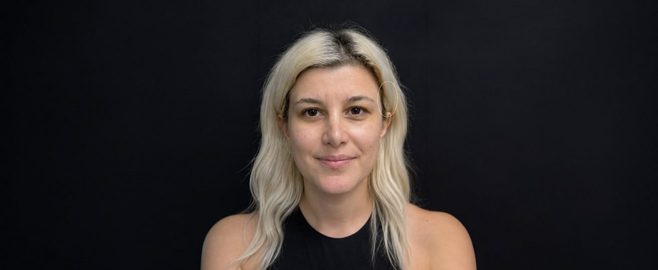 Patient photo after treatment