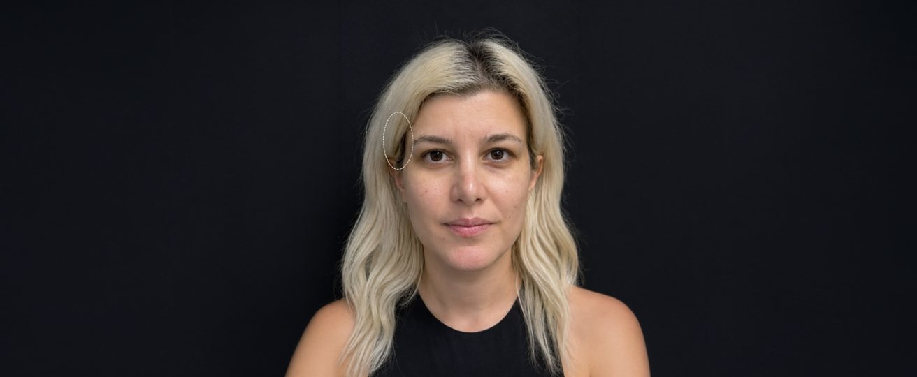 Patient photo before treatment
