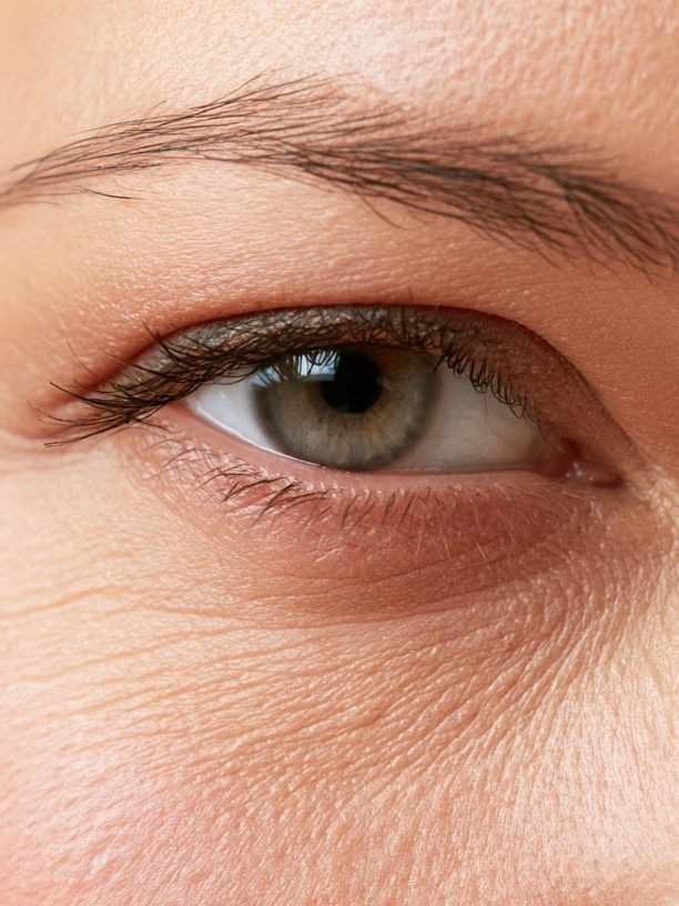 Under-eye Mesotherapy